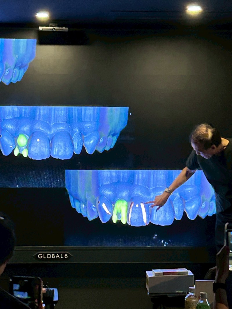 ClinCheck 3Dライブ